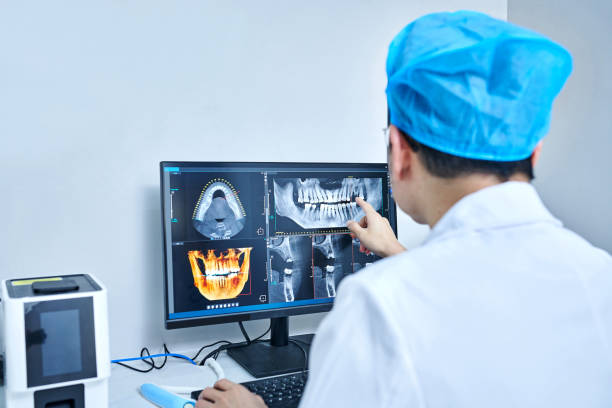 Best Emergency Wisdom Tooth Extraction in Bismarck, ND